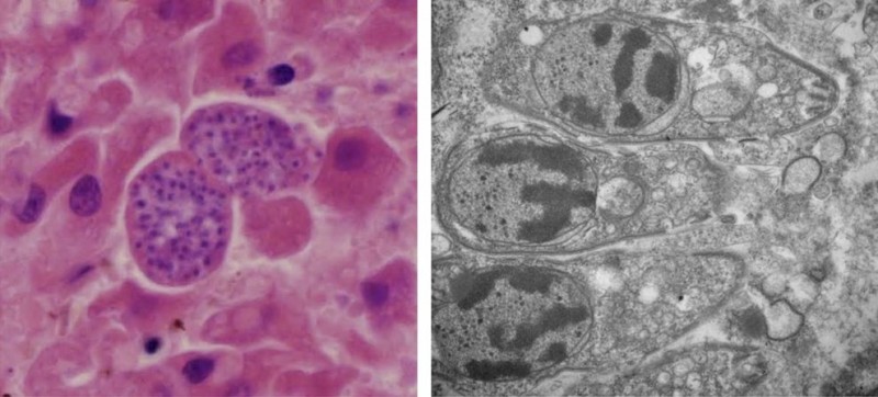 Infecções por S. pinnipedi (em roxo, à esquerda; em cinza escuro, à direita) em fígados de focas-cinzentas, nos quais se observa uma inflamação. Crédito: Dr. Pierre Yves-Daoust