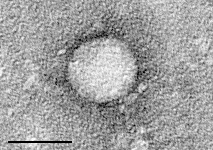 Micrografia eletrônica de um vírus da hepatite C. A barra preta no canto inferior esquerdo corresponde à escala de 50 nanômetros. Crédito: Maria Teresa Catanese, Martina Kopp, Kunihiro Uryu e Charles Rice