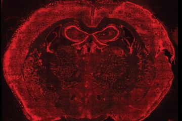 No procedimento estudado, os pesquisadores fixam milhares de RNAs em suas posições nas células, tecidos, órgãos ou embriões. Acima, RNAs marcados por tinta vermelha no cérebro de um rato. Imagem: HMS e  Wyss Institute