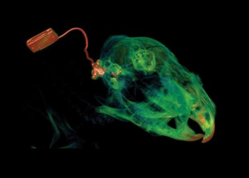 Novas tecnologias prometem reverter a perda de audição