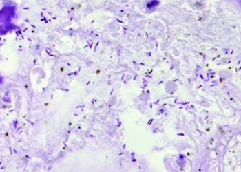 Bactérias combatem tumores em cães e humanos