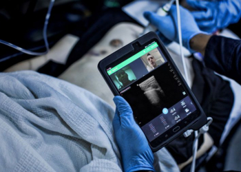 Philips expande a sua oferta de colaboração clínica remota com a plataforma reacts