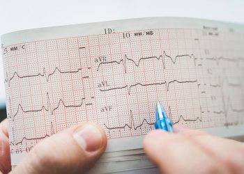 Eletrocardiograma com ia pode ajudar no diagnóstico de covid-19
