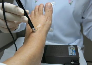 App evoca importância de consultas de podologia no sns