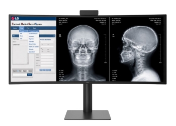Monitor de diagnóstico lg 40ht513d recebe autorização da fda