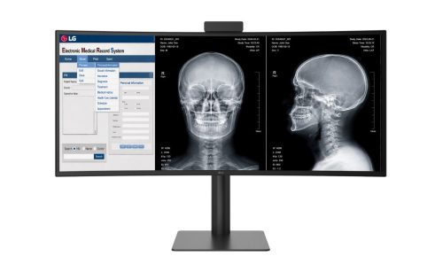 LG Monitor 40HT513D TecheNet Monitor de diagnóstico lg 40ht513d recebe autorização da fda
